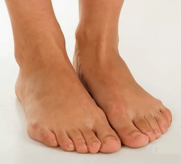 Egészséges lábak a Hondrox spray-vel végzett kezelés után