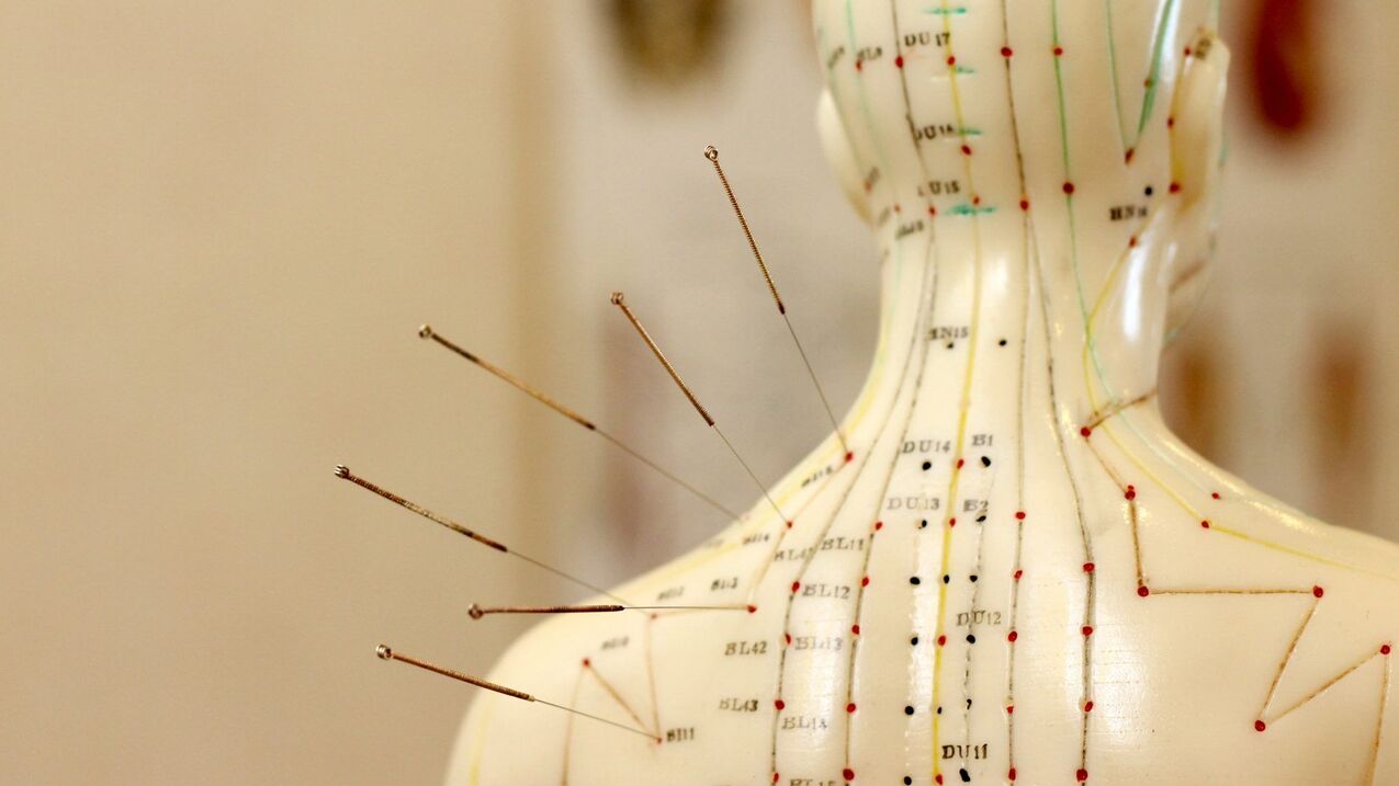 akupunktúra a nyaki osteochondrosishoz