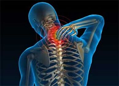 A nyaki fájdalom az osteochondrosis gyakori tünete